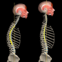 icon Kyphosis(Cifosi e schiena arrotondata da Muscle and Motion
)