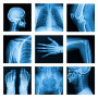 icon Medical X-Ray Interpretation(Medical Interpretazione a raggi X con oltre 100 casi
)