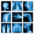 icon Medical X-Ray Interpretation(Medical Interpretazione a raggi X con oltre 100 casi
) 4.0.2